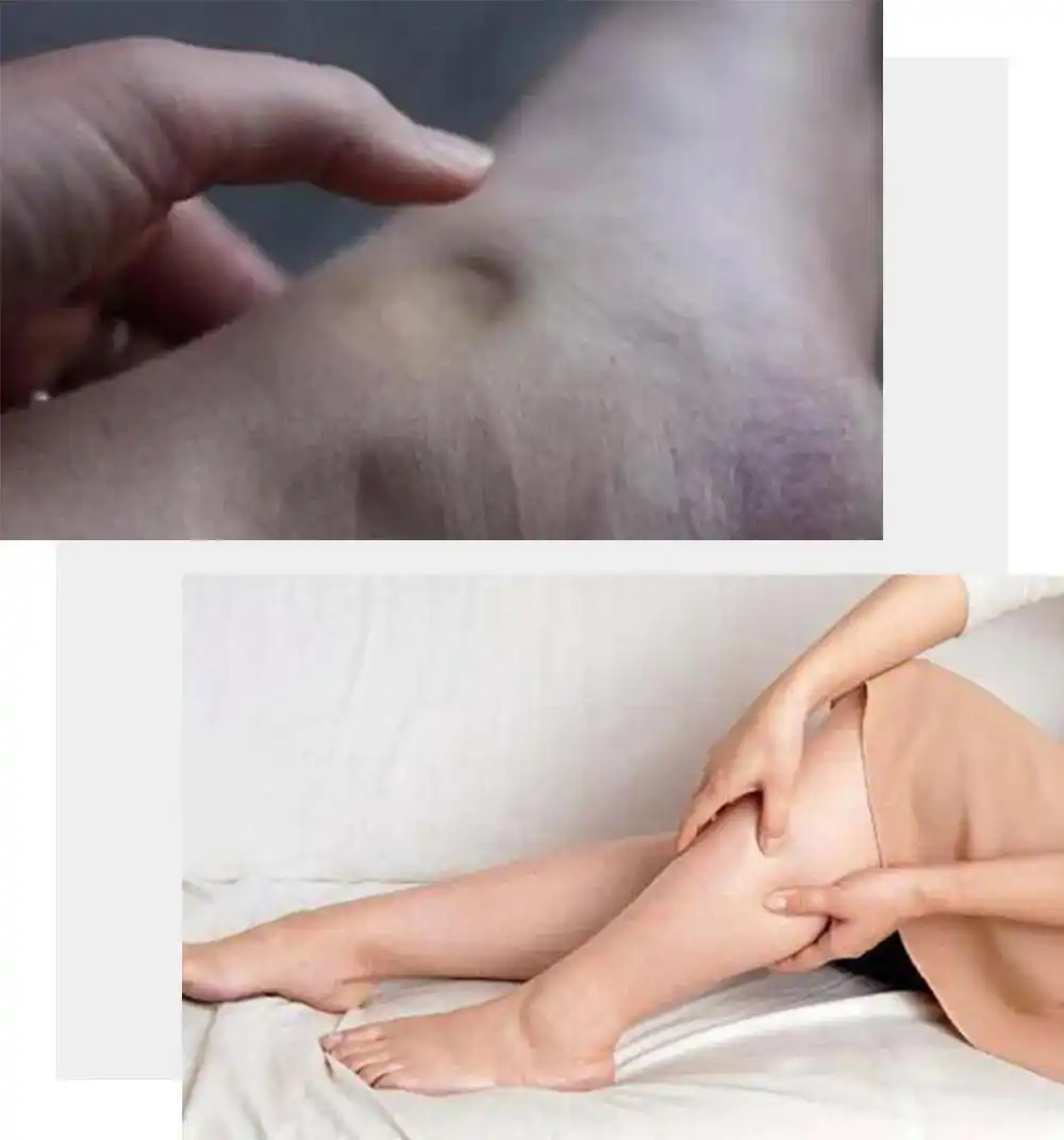 女星的惊人蜕变：瘦腿秘籍大揭秘！ - 第6张